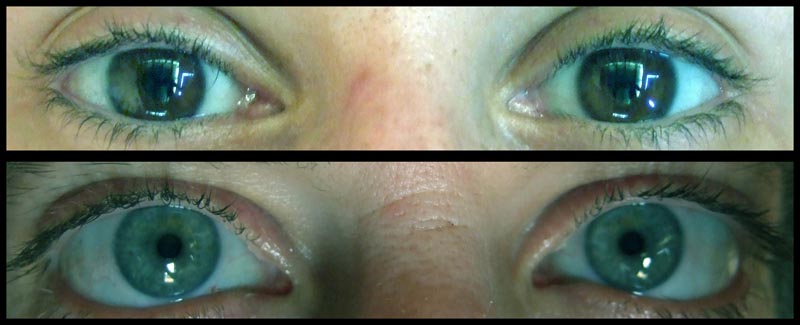 Iboga makes the eyes unusually white